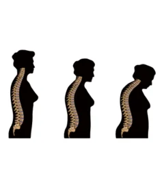 The Incredible Shrinking Woman